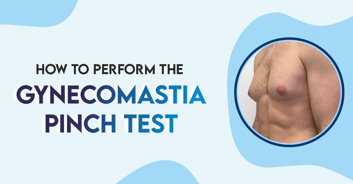 Gynecomastia pinch test